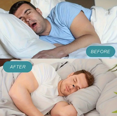 Tiras Nasales Marron Piel original